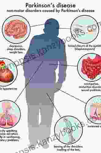 Early Diagnosis And Preventive Therapy In Parkinson S Disease (Key Topics In Brain Research)